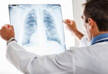 Cuatro hábitos altamente dañinos para la salud respiratoria